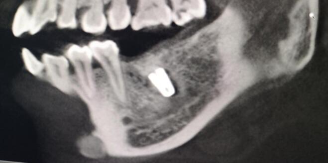 南昌轩牙口腔：手术台上被迫加价 后续报道(图1)